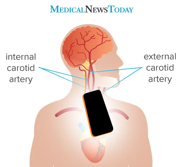 Phone positioning guide